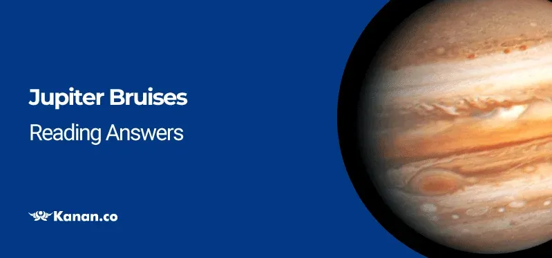 Jupiter Bruises Reading Answers
